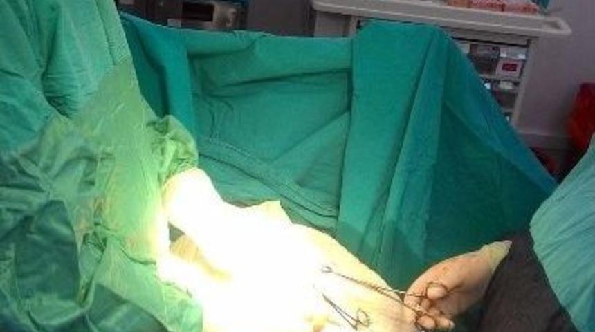 Beş Yaşındaki Çocuğun Karnından 52 Solucan Çıkarıldı