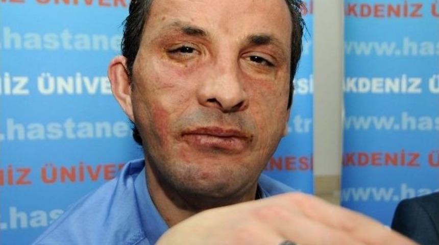 Uğur Acar, Y&uuml;z Naklinin 4. Yılında Grip Nedeniyle Hastanede Tedavi G&ouml;r&uuml;yor