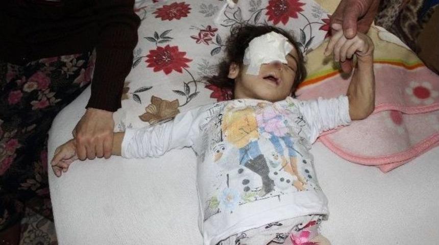 Acı Hissetmediği İ&ccedil;in G&ouml;z&uuml;n&uuml; &Ccedil;ıkarıp Burnunu Par&ccedil;alayan Minik Kız &Ouml;ld&uuml;