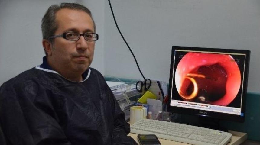 &Ccedil;ocukların Yuttukları Cisimler G&ouml;renleri Şaşırtıyor