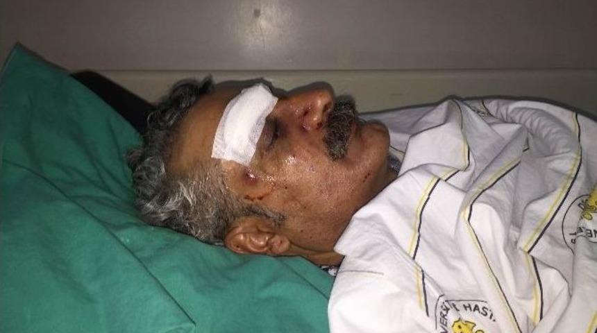 Hdp&rsquo;yi Eleştiren K&uuml;rt Sanat&ccedil;ı Evinin &Ouml;n&uuml;nde Saldırıya Uğradı