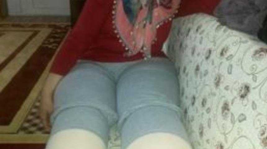 &rsquo;fil Hastalığı&rsquo;na Yakalanan Kadın Ameliyat Olabilmesi İ&ccedil;in Yardım Bekliyor