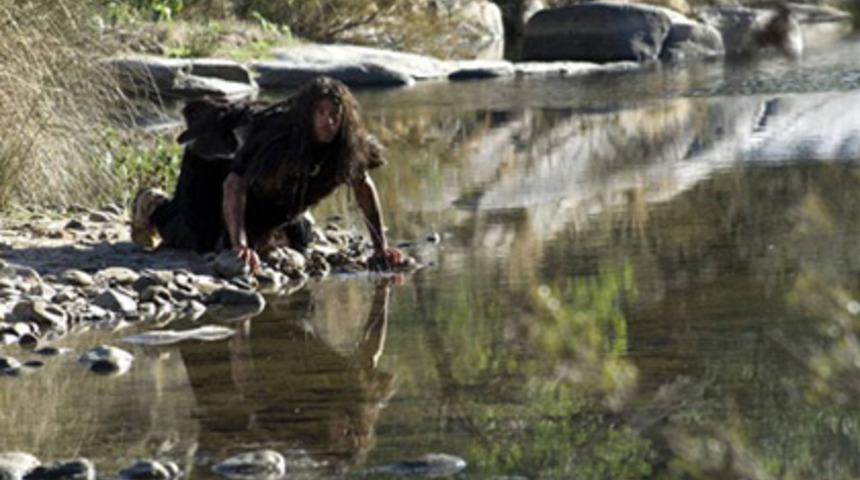 Dünyanın konuştuğu Kurt Adam