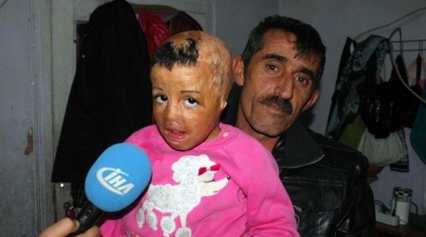 (&ouml;zel Haber) M&uuml;lteci &Ccedil;ocuğun Dramı