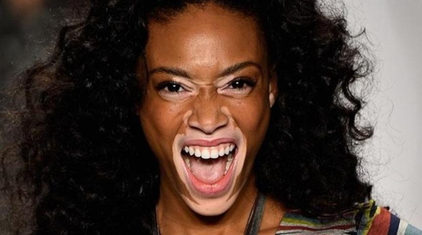 Cilt lekeleriyle milyonlar kazanıyor