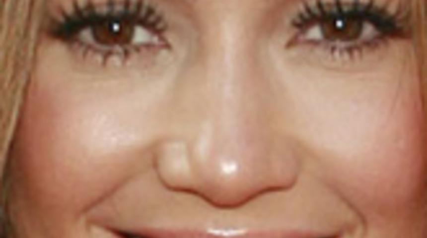 Kaş Alırken Bunlara Dikkat