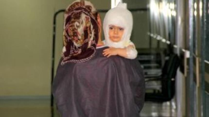 &Uuml;zerine Sıcak Su D&ouml;k&uuml;len &Ccedil;ocuk Yandı