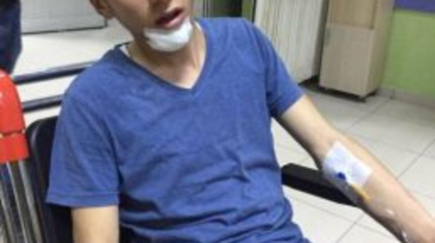 Aksaray’da Çatıdan Düşen Genç Yaralandı