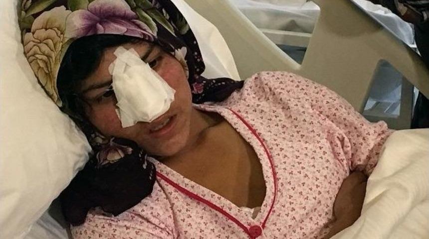 Burnu Kesilen Afgan Kadın Ankara&rsquo;ya Getirildi