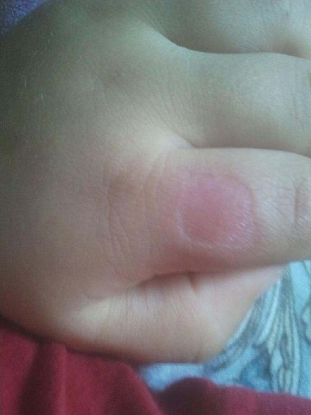 &Ouml;z Babasından, 3 Yaşındaki &Ccedil;ocuğa Şiddet İddiası