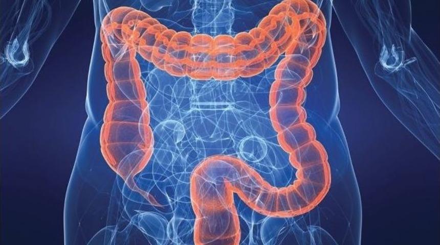 Posalı (lifli) Besinler Kolon Ve Rektum Kanserini &Ouml;nl&uuml;yor