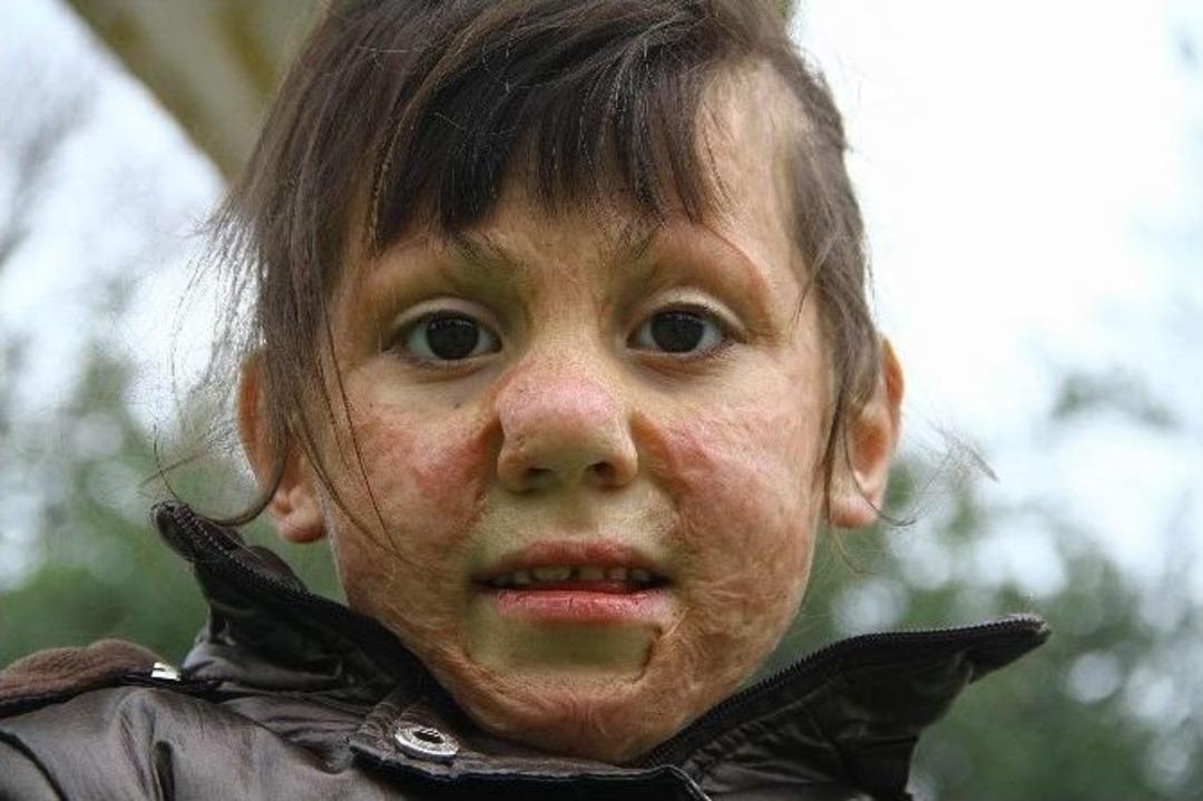 Minik Halime Arkadaşlarıyla Oyun Oynamak İstiyor