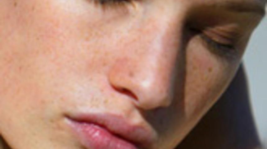 Dudaklarınız Dolgun G&ouml;r&uuml;ns&uuml;n