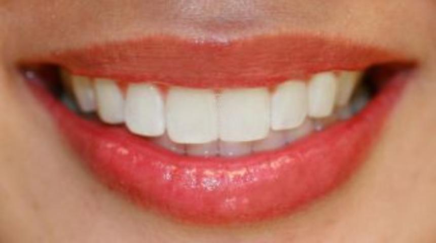 M&uuml;kemmel Dişler &Ouml;zg&uuml;ven Kazandırıyor