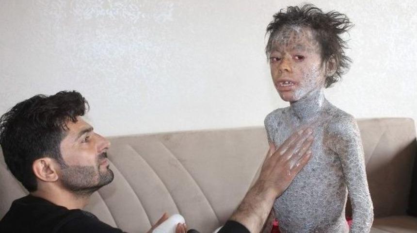 K&uuml;&ccedil;&uuml;k Melih&rsquo;in Dramı Y&uuml;rek Burkuyor