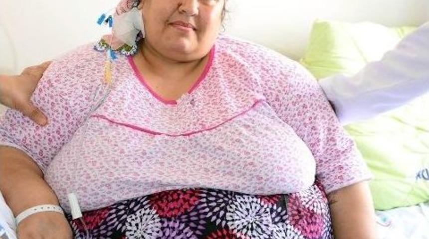 220 Kilo Olan Kadına Başarılı Mide Ameliyatı