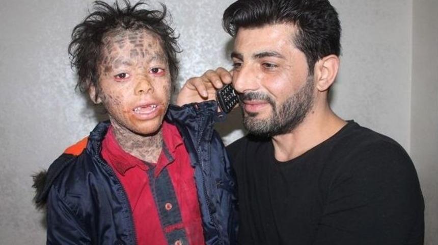 İha&rsquo;nın Haberi Ses Getirdi, Mardinli K&uuml;&ccedil;&uuml;k Melih&rsquo;e Destek Yağdı