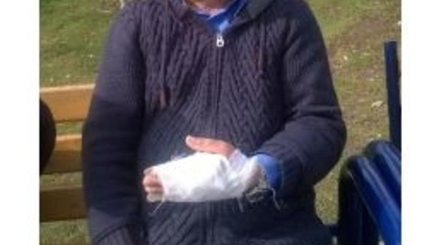 Bağ Budayan Şahıs Parmaklarını Kesti