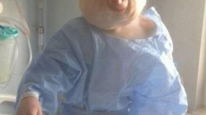 (özel Haber) Türkiye’nin Yüreğini Burkan Çocuk Ameliyat Oldu