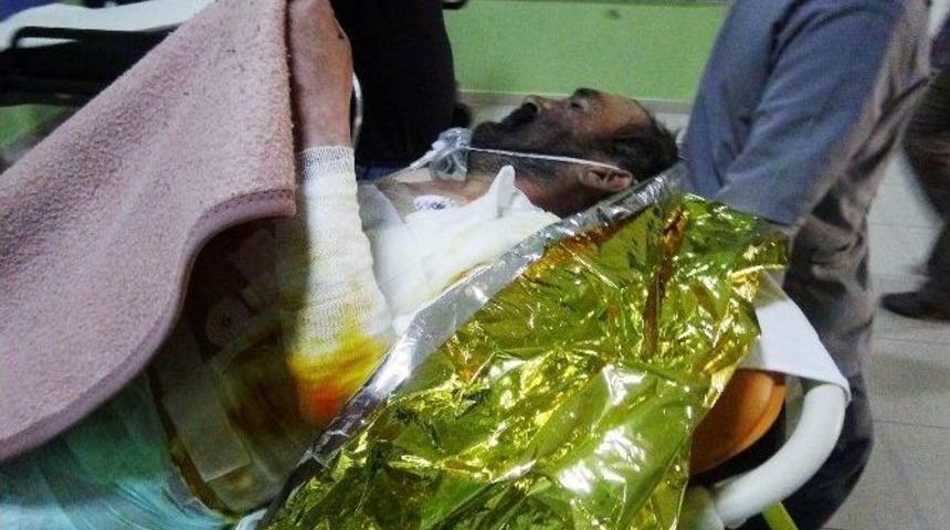 Yangına Uykusunda Yakalandı, Yanarak Yaralandı