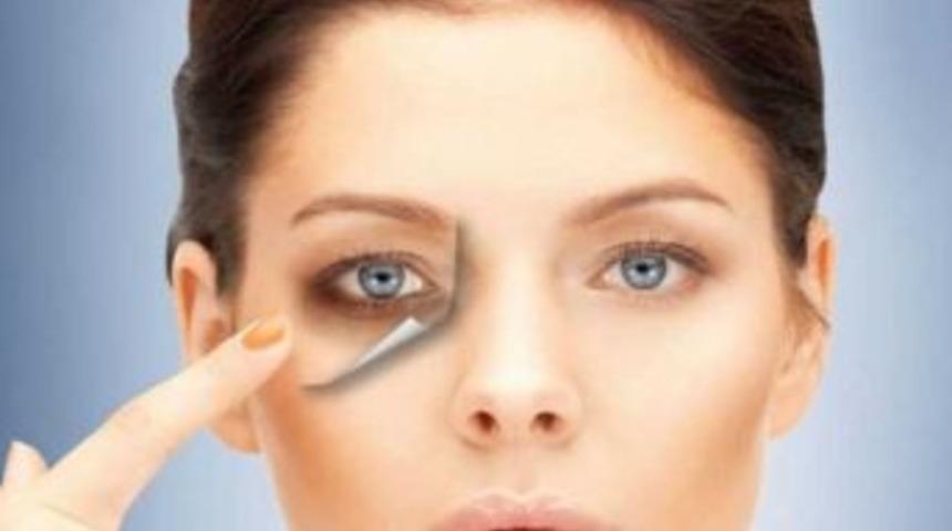 G&ouml;zaltı Morluğuna Ve Torbalanmalarına Son