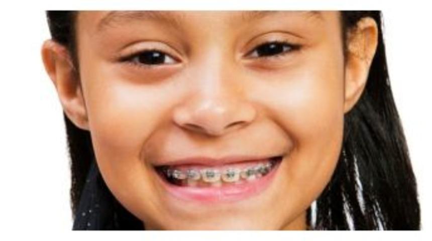 Ağızdan Nefes Alma &Ccedil;ocuklarda Diş Yapısını Bozuyor