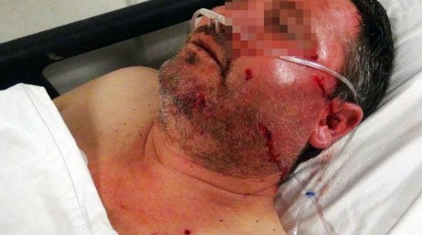 Aile Kavgasında T&uuml;fekler Konuştu: 2 Yaralı