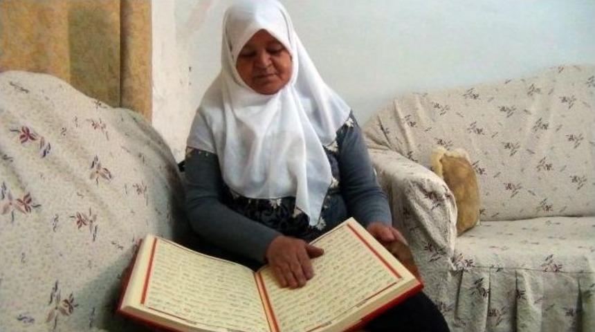 (&ouml;zel Haber) &lsquo;portakal Kabuğu&rsquo; Y&uuml;z&uuml;nden Hayatı Değişti