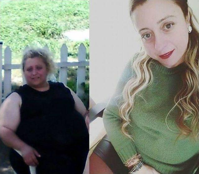 Bir Yılda 70 Kilo Verdi, Hayatı Değişti