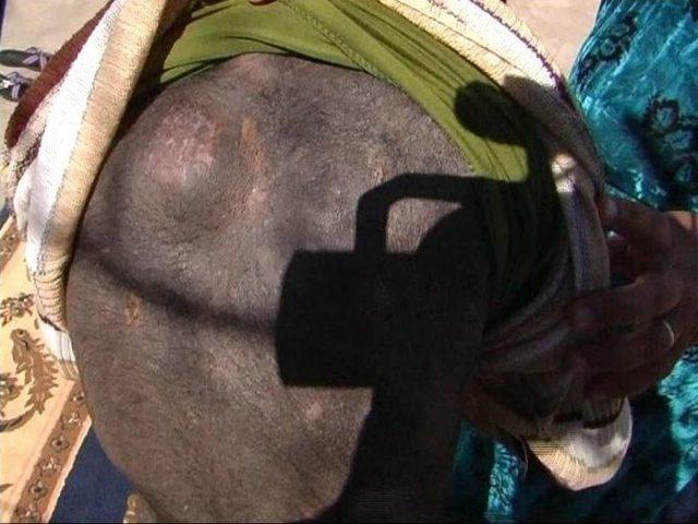 10 Yaşındaki Suriyeli Kızın Dramı Y&uuml;rek Burkuyor 2