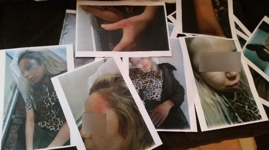 (&ouml;zel Haber) Eski Nişanlısından İşkence G&ouml;ren Kadına İha Ulaştı