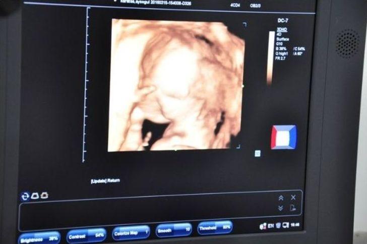 Çocuğu Olmayanların Yeni Umudu ’çip Bebek’ Yöntemi G3