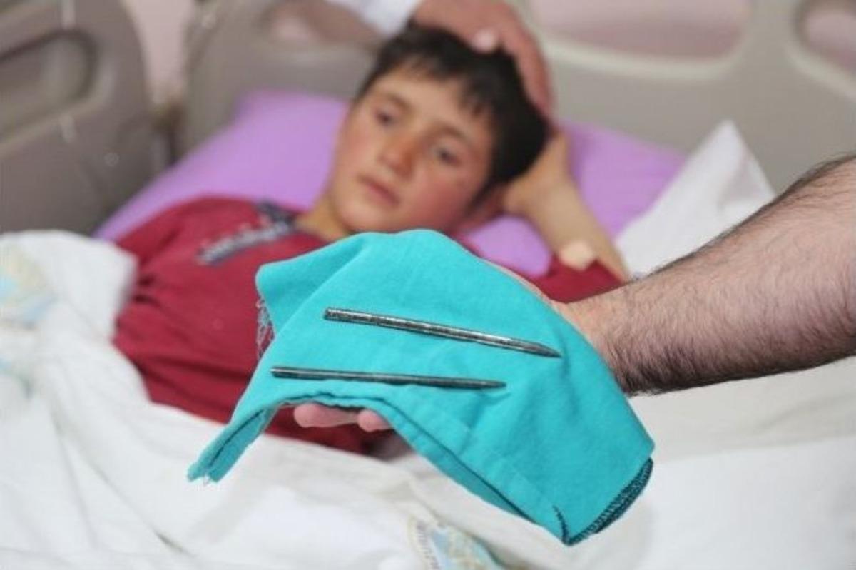 Kasığına Dirgen Saplanan &Ccedil;ocuk Erzurum Beah&rsquo;ta Sakat Kalmaktan Kurtarıldı