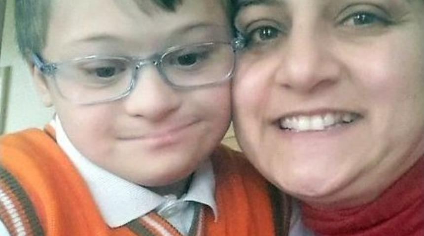 "down Sendromlu Olmak Engel Değildir"