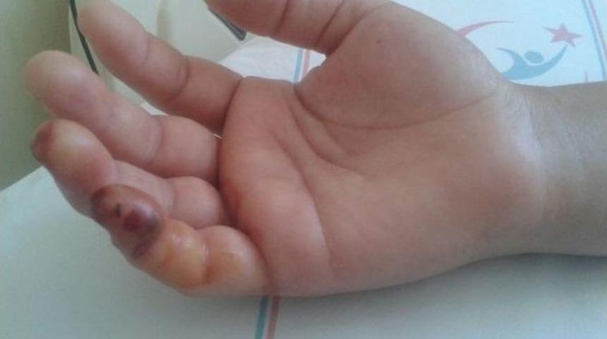 Trakonya Balığı Talihsiz Kadını Canından Edecekti