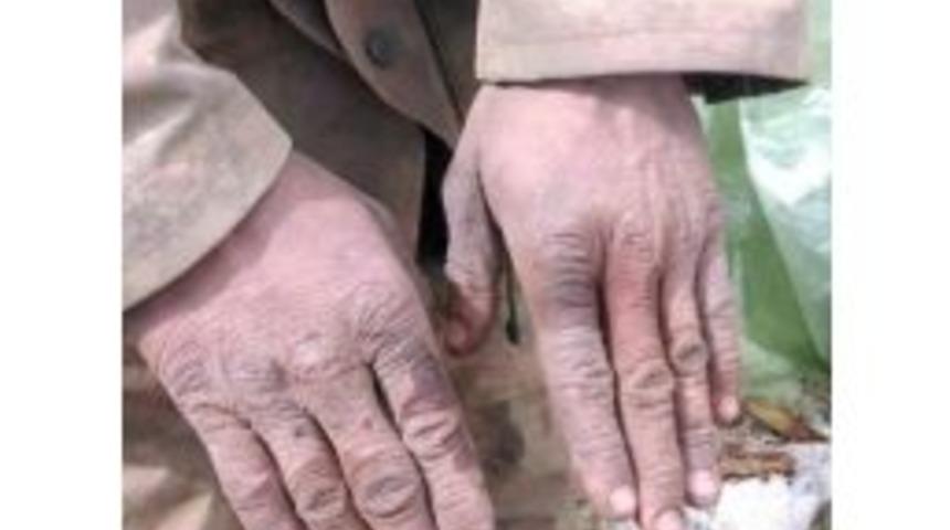 İşte Eli &Ouml;p&uuml;lesi Mehmet&ccedil;ik