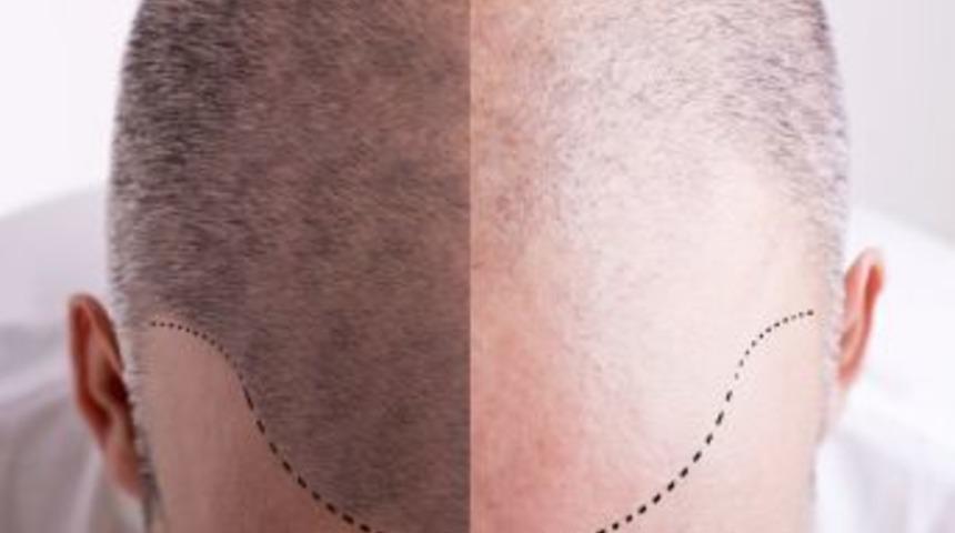 Organik Sa&ccedil; Ekiminin De Taklidi &Ccedil;ıktı