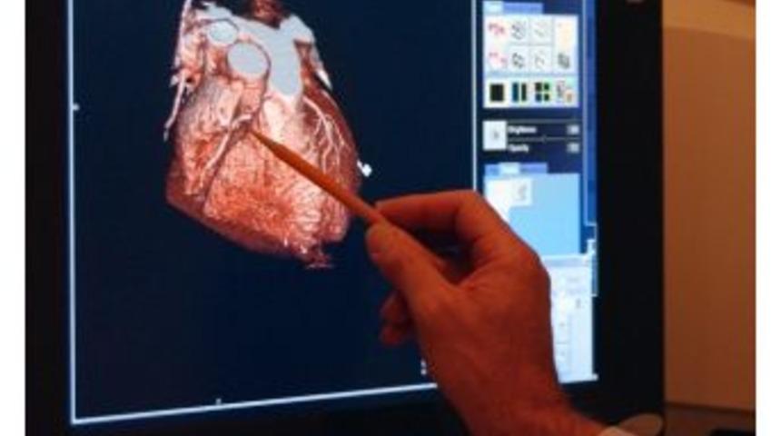 Kalp Damarlarında Oluşan Darlık Kalp Hastalığının En Sık Sebeplerinden