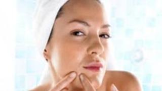 Herkesin Sorunu Sivilce mi ? Akne Mi ?