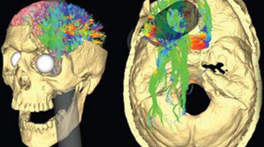 164 yıllık mucizenin sırrı çözüldü