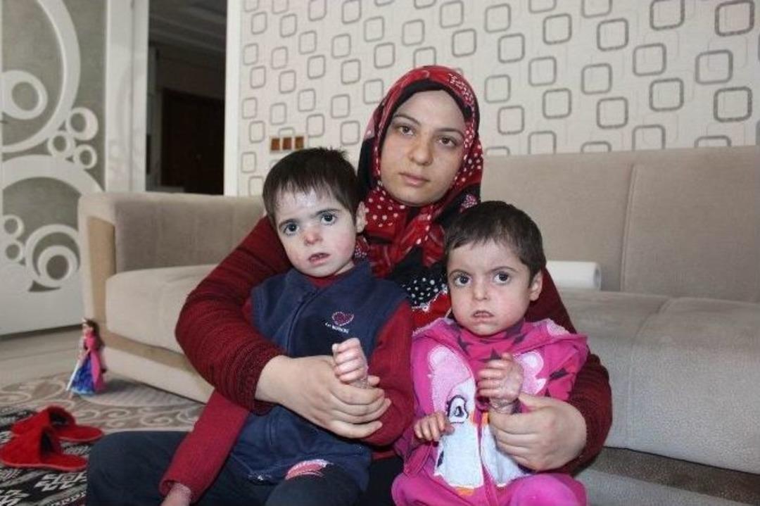 (&ouml;zel Haber) Doğuştan Yaralılar