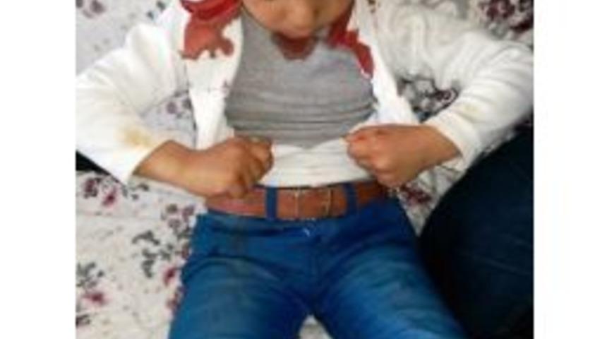 Patnos&rsquo;ta Sokak K&ouml;peği Dehşeti