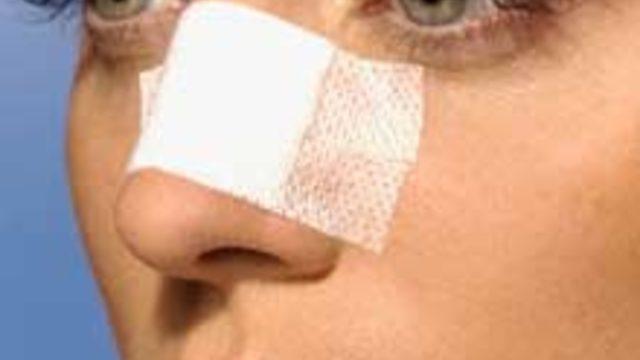 Burun Estetiğinde Son Trend: Gölgelendirme ve Parlatma