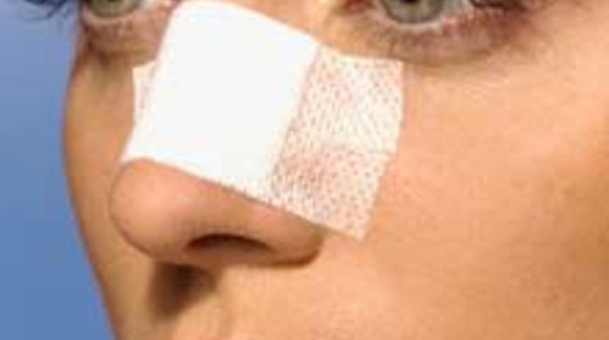 Burun Estetiğinde Son Trend: Gölgelendirme ve Parlatma