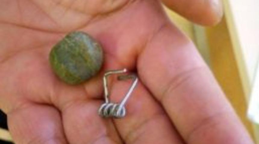 Suriyeli Gen&ccedil;, &Ccedil;amaşır Mandalı Yutarak İntihar Etmek İstedi