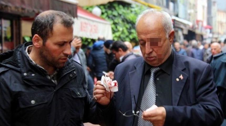 Yumruklu Saldırı: 1 Yaralı