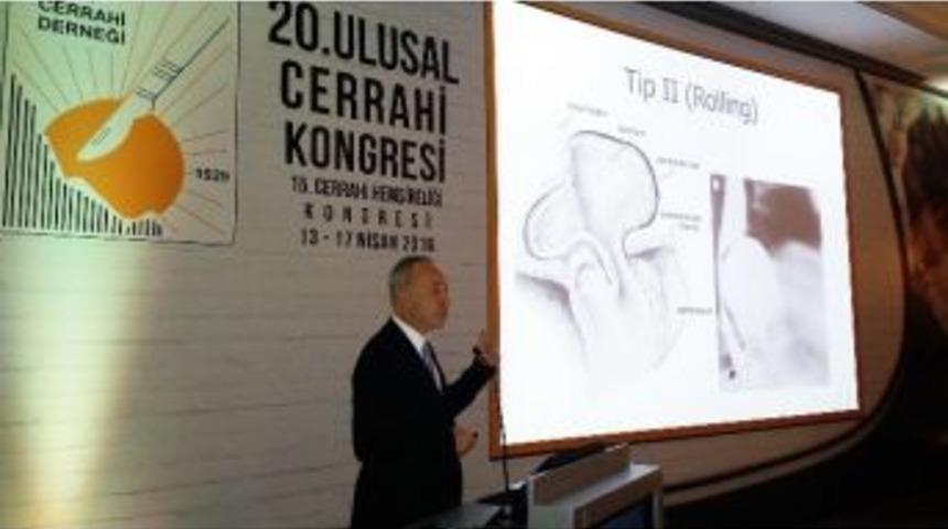 Refl&uuml;de Laparoskopik Cerrahi