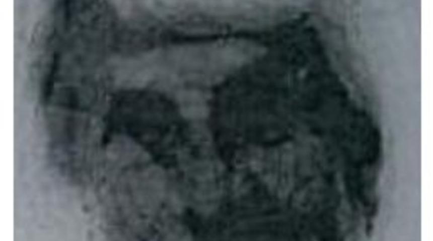 Havuz Başında G&uuml;neşlenen Yaşlı Turist Kalp Krizi Ge&ccedil;irip &Ouml;ld&uuml;