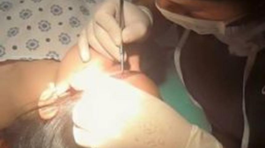 Yeni Moda Kaş Ekimi