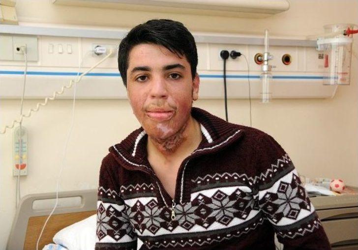 Bombalı Saldırıda Boynu Yanan Genç, Antalya’da Sağlığına Kavuştu